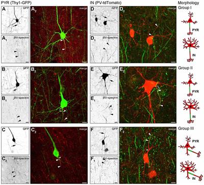 Heterogeneity of the Axon Initial Segment in Interneurons and Pyramidal Cells of Rodent Visual Cortex